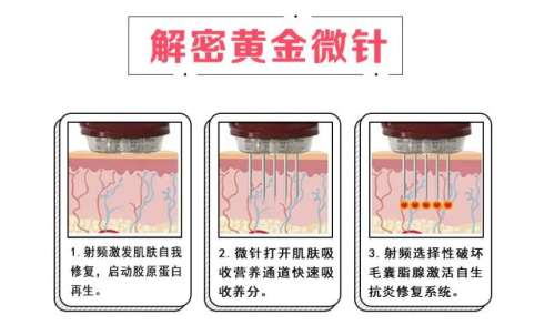 微针美容的大概费用是多少？个人情况、医院医生选择会影响价格！