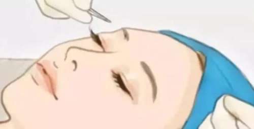 眼部整形动漫02.jpg 眼部整形动漫02.jpg
