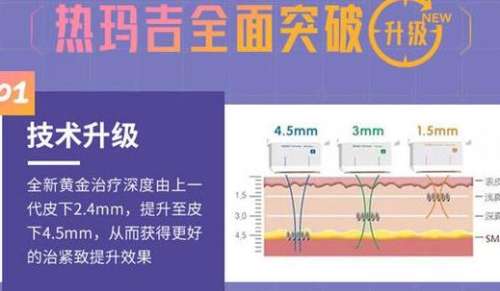 热玛吉5代多少钱一次？在操作的时候如何选择医院呢？